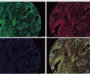 免疫螢光染色(IMMUNOFLUORESCENCE